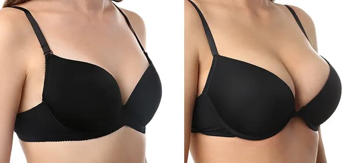 Gdzie zrobić operację biustu? Top 10 klinik i chirurgów w Polsce