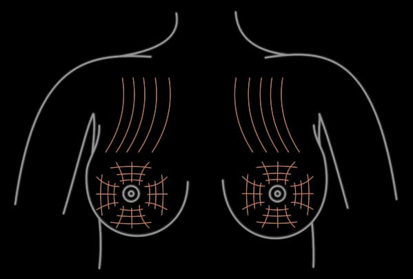 Ile kosztuje korekta biustu? Ceny i czynniki wpływające na koszt